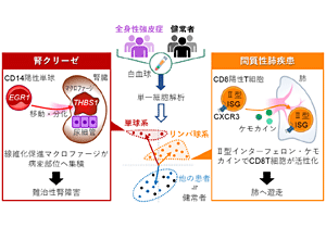 指定難病「全身性強皮症」の命にかかわる病変を予測する免疫細胞の「サイン」を発見