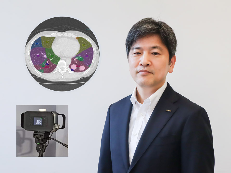 【特集：ニッポンAIの明日】第5回 医療現場の個別ニーズに寄り添った事業を国内外で展開、富士フイルム